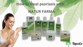 How to treat psoriasis with NATUR FARMA